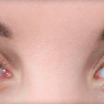 Методы наращивания ресниц