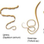 Паразиты в организме человека Паразиты в организме человека