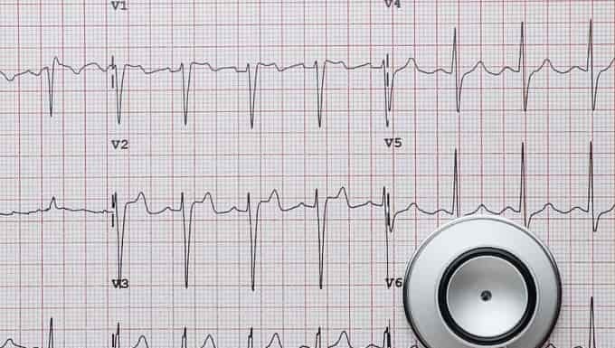 ЕКГ: штрихи до портрета серця