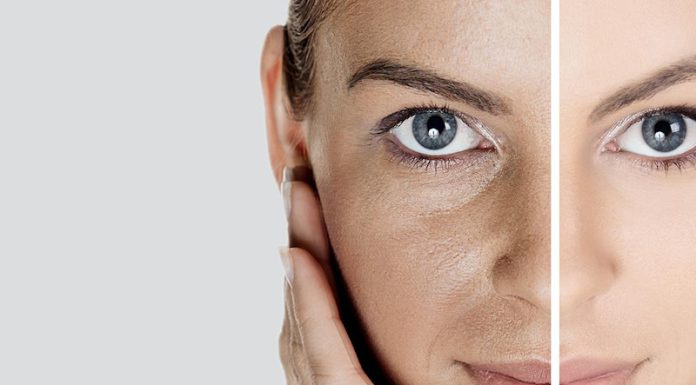 Тьмяна шкіра: як повернути природне сяйво обличчя