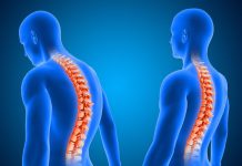 Гемангіома хребця