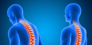 Гемангіома хребця