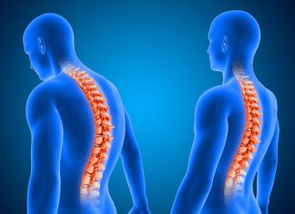 Гемангіома хребця