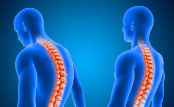 Гемангіома хребця: чи завжди є привід для хвилювання? Гемангіома хребця