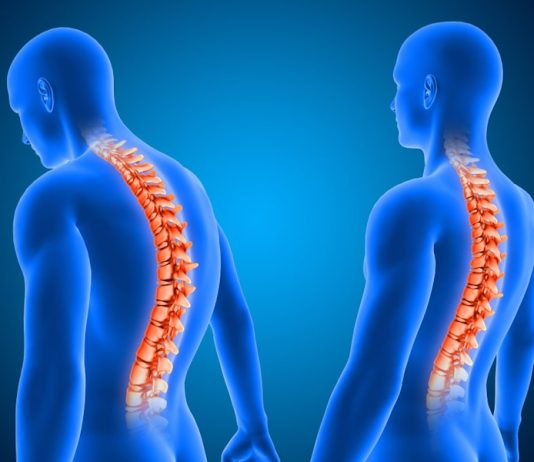 Гемангіома хребця: чи завжди є привід для хвилювання? Гемангіома хребця