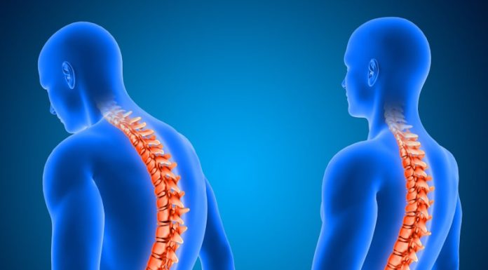 Гемангіома хребця: чи завжди є привід для хвилювання? Гемангіома хребця