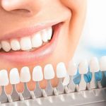 Отбеливание зубов