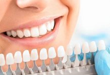 Отбеливание зубов