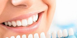 Отбеливание зубов