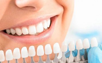 Отбеливание зубов