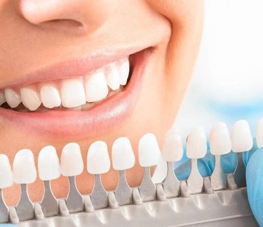 Отбеливание зубов