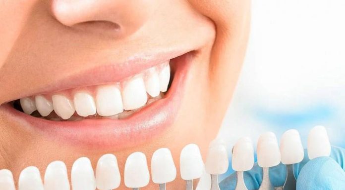 Отбеливание зубов