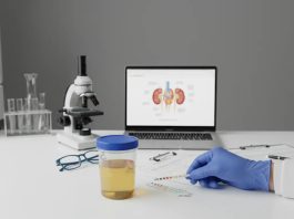 Анализ мочи: 48-часовая подготовка Анализ мочи