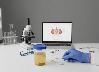 Анализ мочи: 48-часовая подготовка Анализ мочи