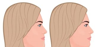 Уменьшение подбородка: как исправить то, что мешает нравиться себе в зеркале Уменьшение подбородка