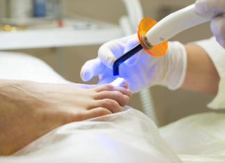 Протезирование ногтей: что это и зачем нужно Протезирование ногтей