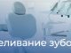 Вкусный Таллинн и отбеливание зубов отбеливание зубов